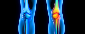 Read more about the article 5 Ways to Improve Your Joint Health